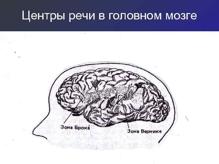 Центры речи в головном мозге 