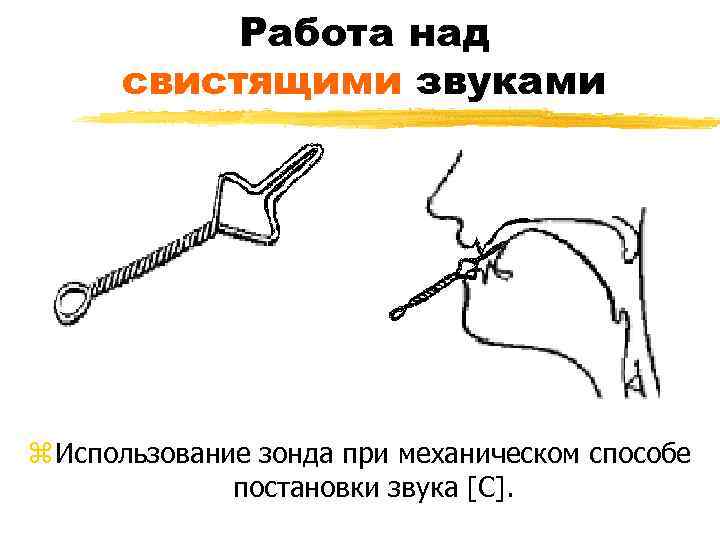 Работа над свистящими звуками z Использование зонда при механическом способе постановки звука [С]. 