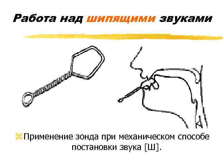 Работа над шипящими звуками z Применение зонда при механическом способе постановки звука [Ш]. 