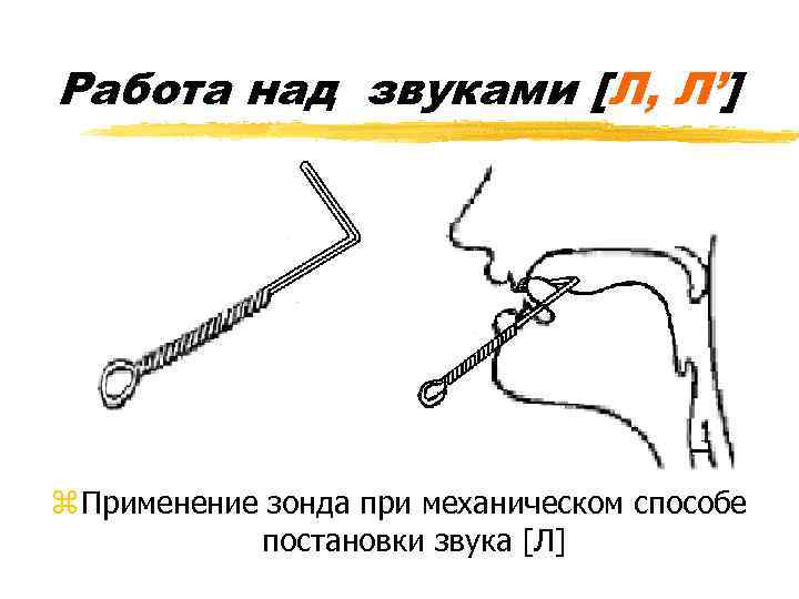 Работа над звуками [Л, Л’] z Применение зонда при механическом способе постановки звука [Л]