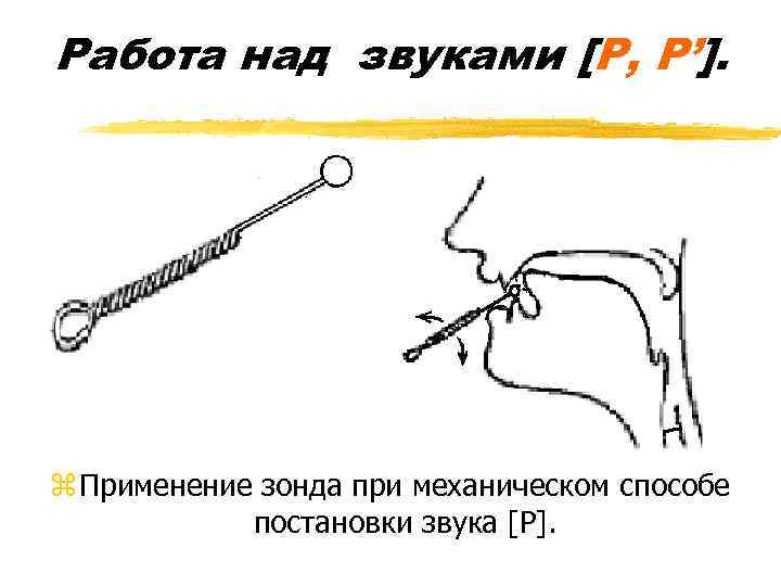 Работа над звуками [Р, Р’]. z Применение зонда при механическом способе постановки звука [Р].