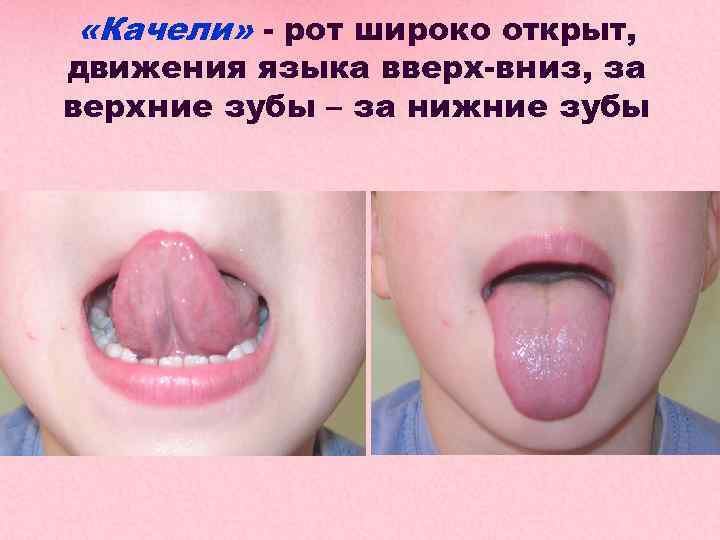  «Качели» - рот широко открыт, движения языка вверх-вниз, за верхние зубы – за
