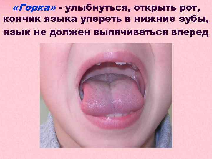  «Горка» - улыбнуться, открыть рот, кончик языка упереть в нижние зубы, язык не
