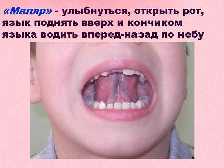  «Маляр» - улыбнуться, открыть рот, язык поднять вверх и кончиком языка водить вперед-назад