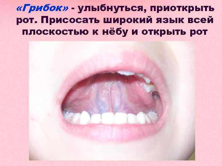  «Грибок» - улыбнуться, приоткрыть рот. Присосать широкий язык всей плоскостью к нёбу и