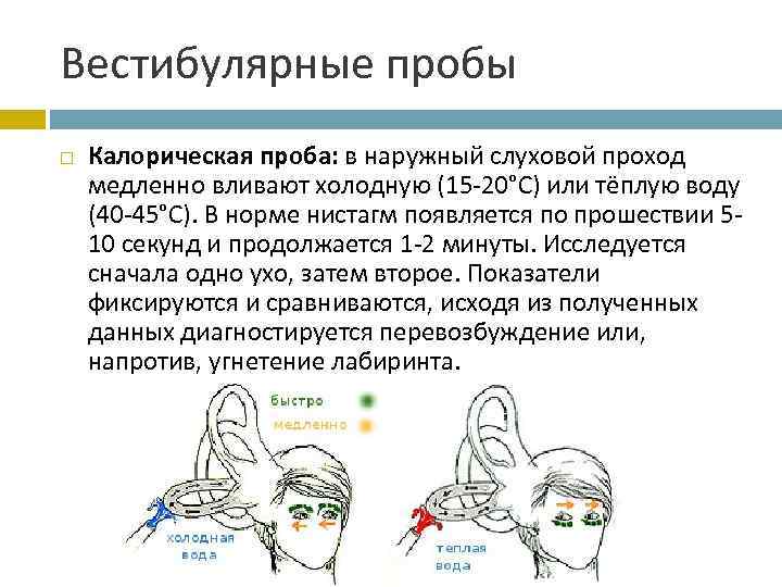 Вестибулярные пробы Калорическая проба: в наружный слуховой проход медленно вливают холодную (15 -20°С) или