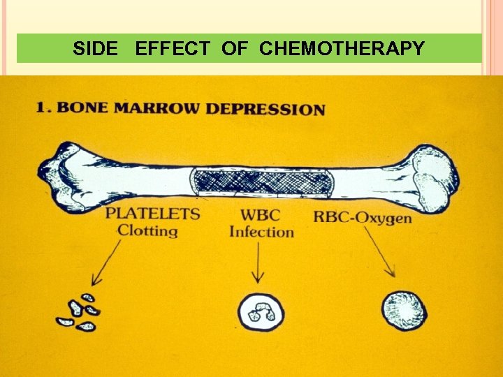 SIDE EFFECT OF CHEMOTHERAPY 