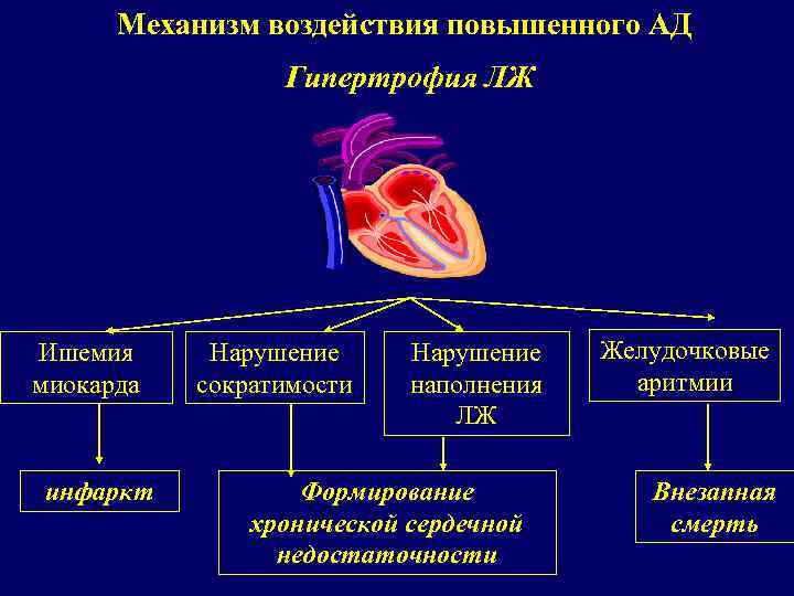 Механизм воздействия повышенного АД Гипертрофия ЛЖ Ишемия миокарда инфаркт Нарушение сократимости Нарушение наполнения ЛЖ