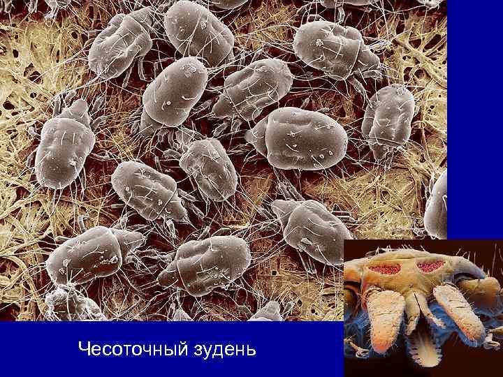 Чесоточный зудень 