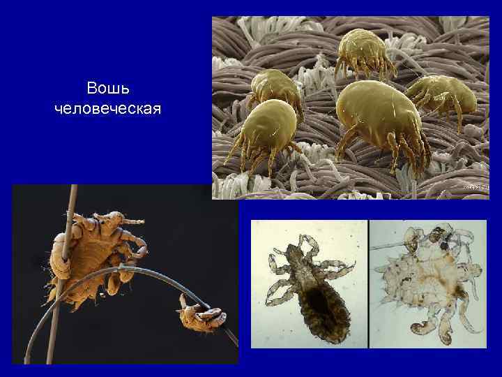 Вошь человеческая 