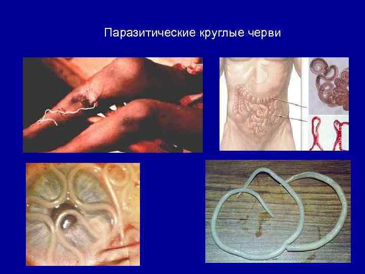 Паразитические круглые черви 