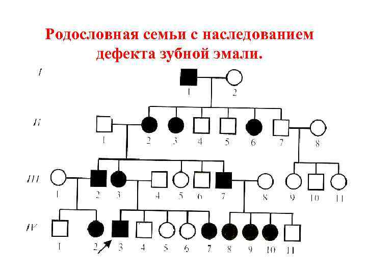 Родословная семьи с наследованием дефекта зубной эмали. 
