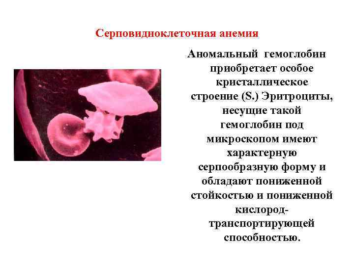 Серповидноклеточная анемия Аномальный гемоглобин приобретает особое кристаллическое строение (S. ) Эритроциты, несущие такой гемоглобин