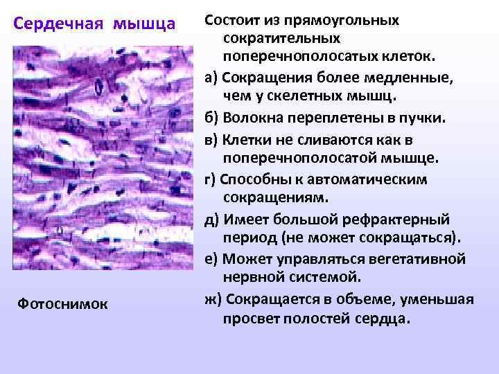 Сердечная мышца Фотоснимок Состоит из прямоугольных сократительных поперечнополосатых клеток. а) Сокращения более медленные, чем