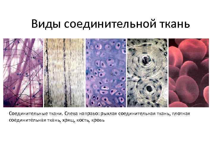Виды соединительной ткань Соединительные ткани. Слева направо: рыхлая соединительная ткань, плотная соединительная ткань, хрящ,