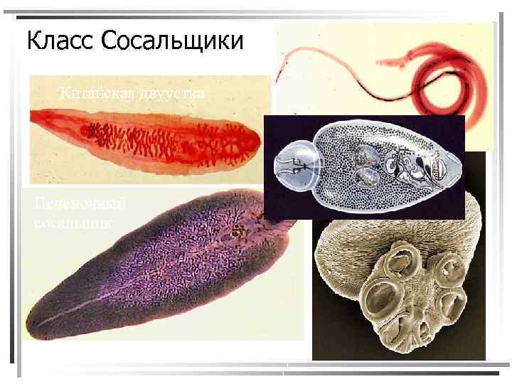 Класс Сосальщики Китайская двуустка Кровяная двуустка Печеночный сосальщик 