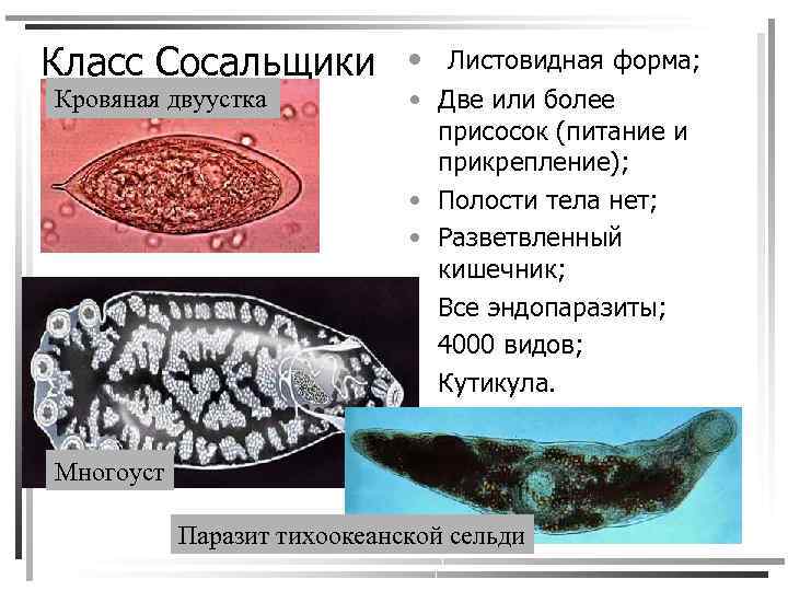 Класс Сосальщики Кровяная двуустка • Листовидная форма; • Две или более присосок (питание и