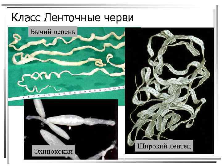 Класс Ленточные черви Бычий цепень Эхинококки Широкий лентец 