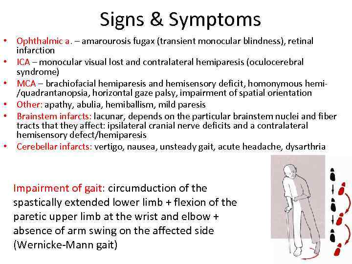 Signs & Symptoms • Ophthalmic a. – amarourosis fugax (transient monocular blindness), retinal infarction