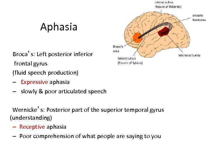 Aphasia Broca’s: Left posterior inferior frontal gyrus (fluid speech production) – Expressive aphasia –