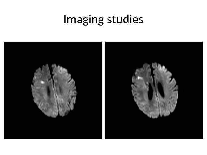 Imaging studies 