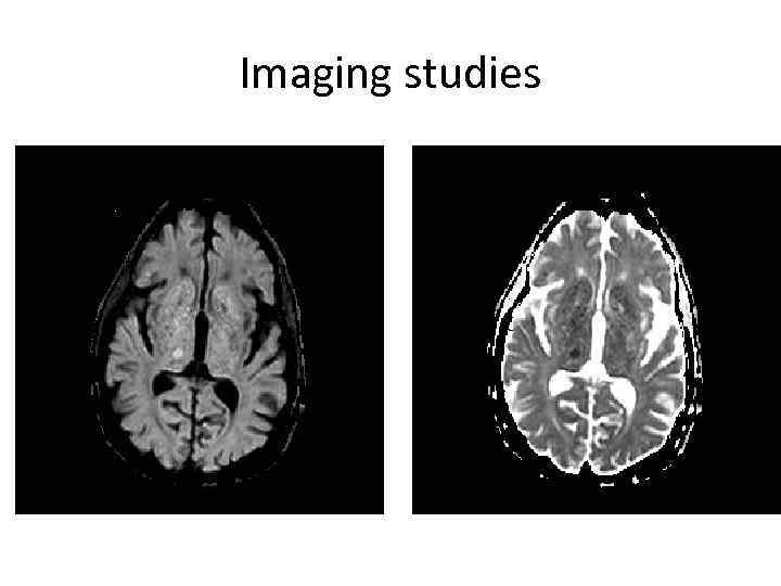 Imaging studies 