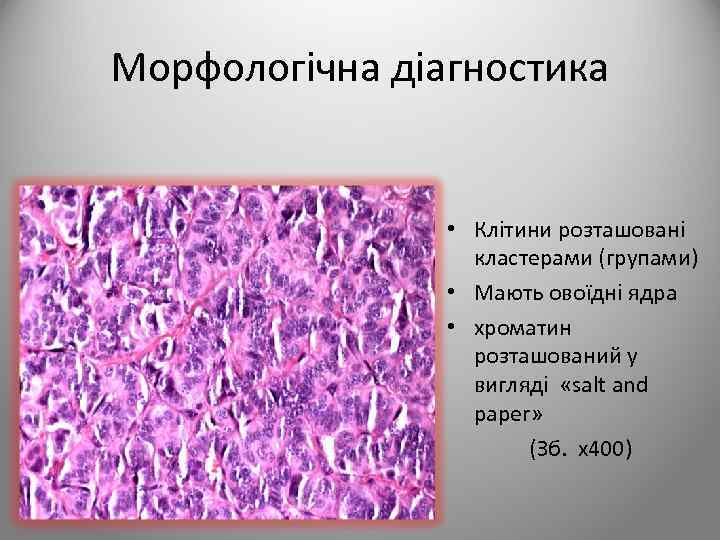 Морфологічна діагностика • Клітини розташовані кластерами (групами) • Мають овоїдні ядра • хроматин розташований