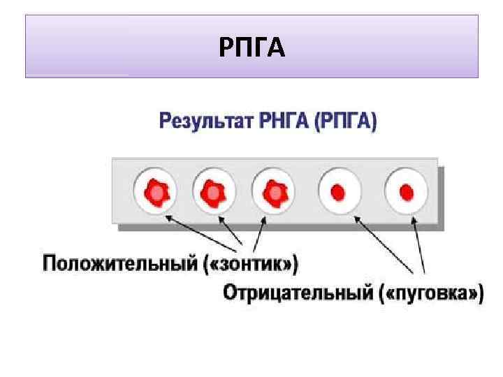 РПГА 