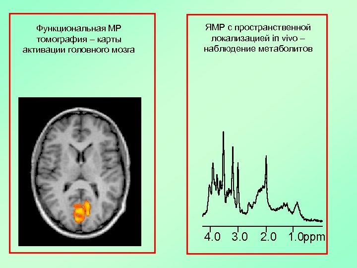 Функциональная МР томография – карты активации головного мозга ЯМР с пространственной локализацией in vivo