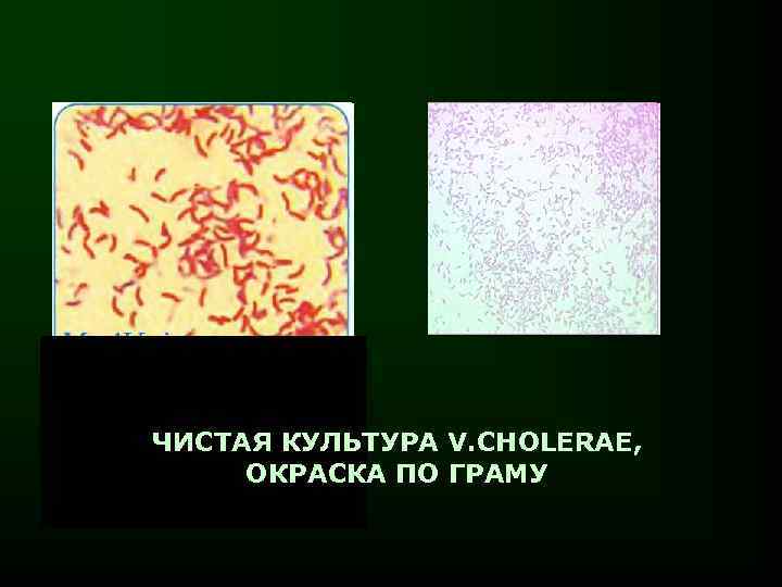 ЧИСТАЯ КУЛЬТУРА V. CHOLERAE, ОКРАСКА ПО ГРАМУ 