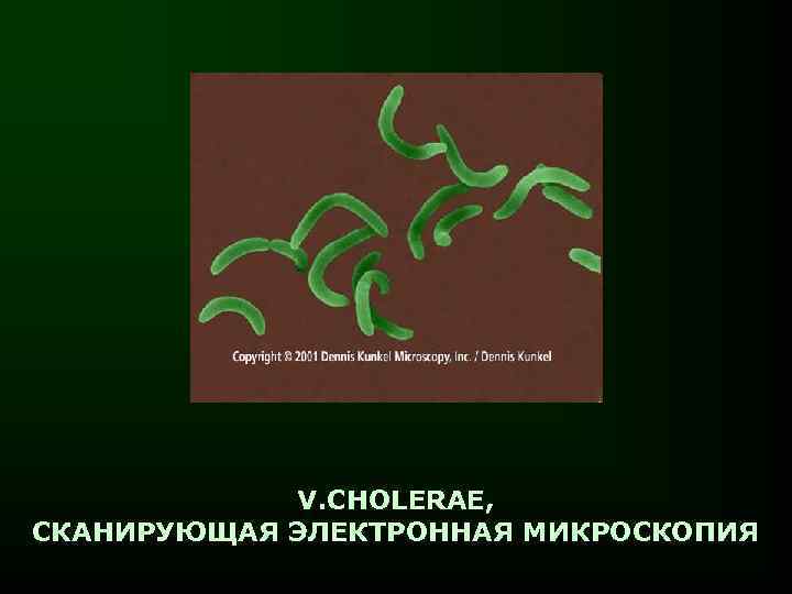 V. CHOLERAE, СКАНИРУЮЩАЯ ЭЛЕКТРОННАЯ МИКРОСКОПИЯ 