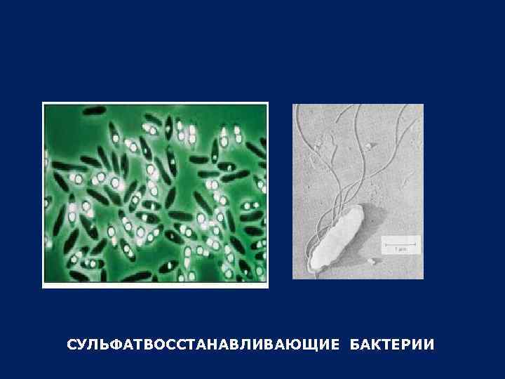 СУЛЬФАТВОССТАНАВЛИВАЮЩИЕ БАКТЕРИИ 