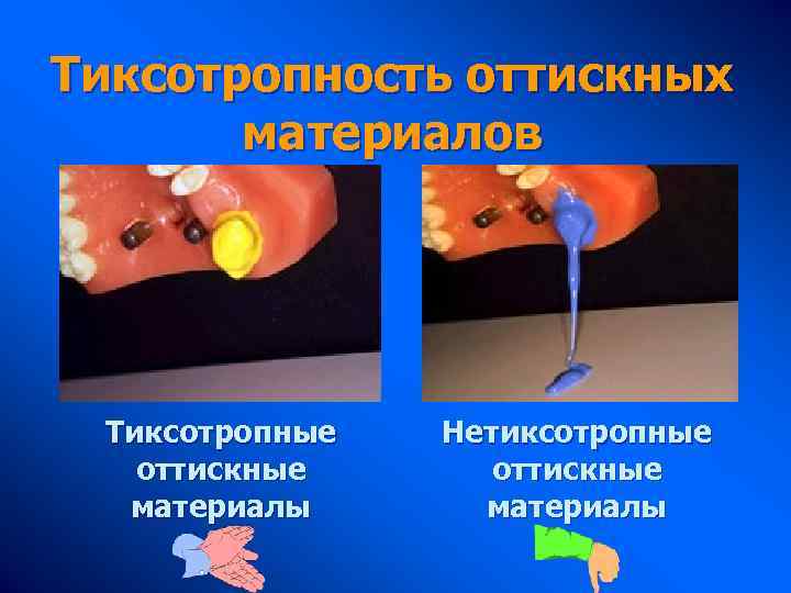 Тиксотропность оттискных материалов Тиксотропные оттискные материалы Нетиксотропные оттискные материалы 