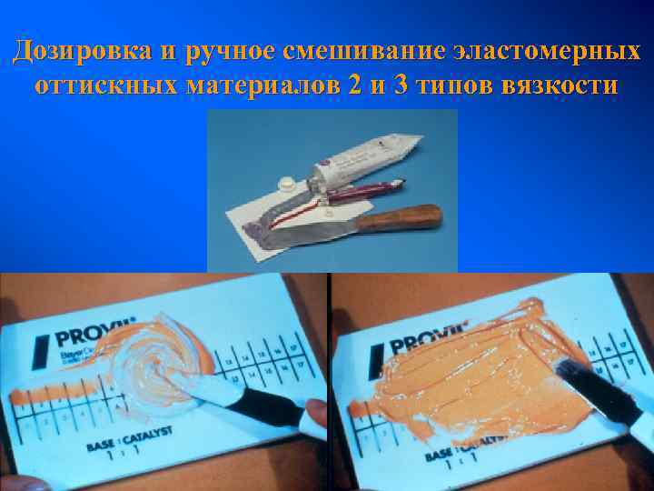 Дозировка и ручное смешивание эластомерных оттискных материалов 2 и 3 типов вязкости Н. Полоней