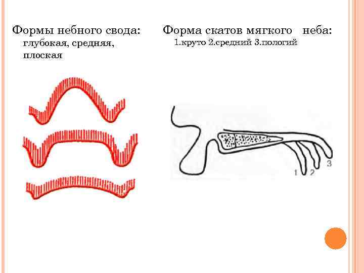 Формы небного свода: глубокая, средняя, плоская Форма скатов мягкого неба: 1. круто 2. средний