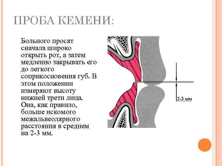 Центральная окклюзия и центральное соотношение