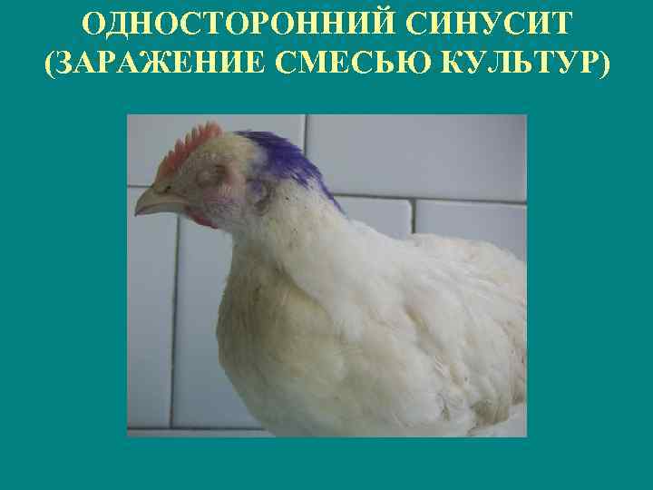 ОДНОСТОРОННИЙ СИНУСИТ (ЗАРАЖЕНИЕ СМЕСЬЮ КУЛЬТУР) 