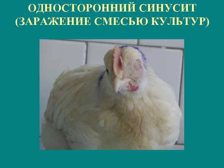 ОДНОСТОРОННИЙ СИНУСИТ (ЗАРАЖЕНИЕ СМЕСЬЮ КУЛЬТУР) 