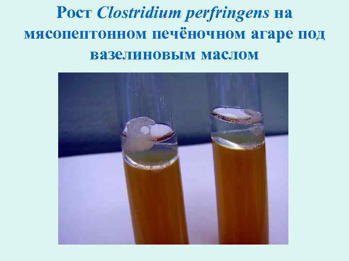 Рост Clostridium perfringens на мясопептонном печёночном агаре под вазелиновым маслом 