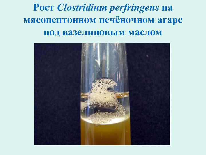 Рост Clostridium perfringens на мясопептонном печёночном агаре под вазелиновым маслом 