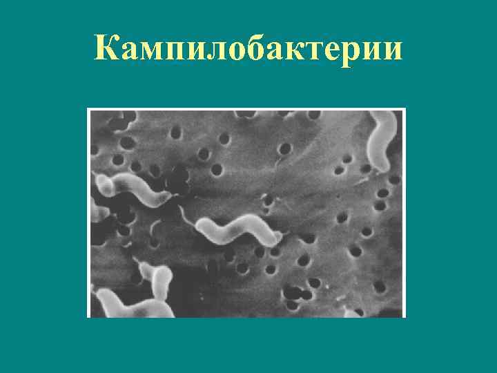 Кампилобактерии 