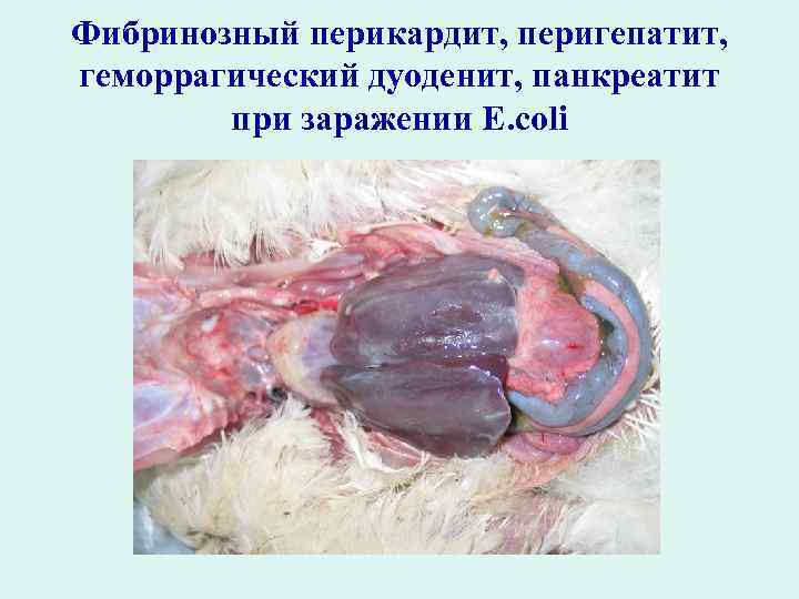 Фибринозный перикардит, перигепатит, геморрагический дуоденит, панкреатит при заражении E. coli 