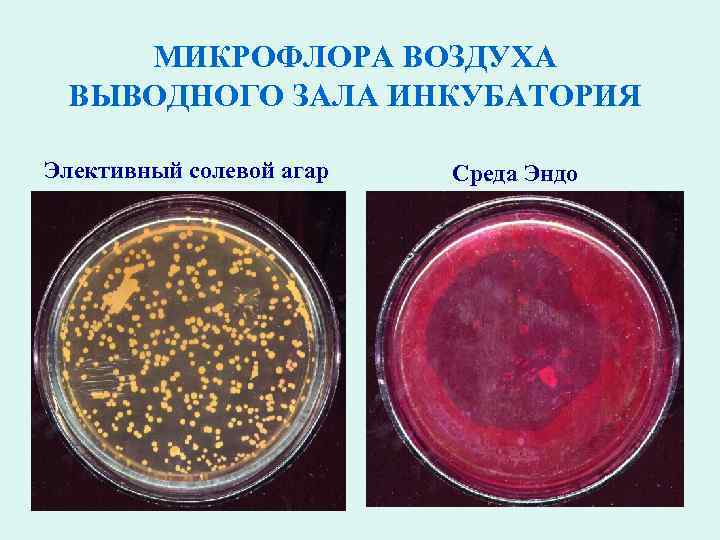 Проект микрофлора воздуха