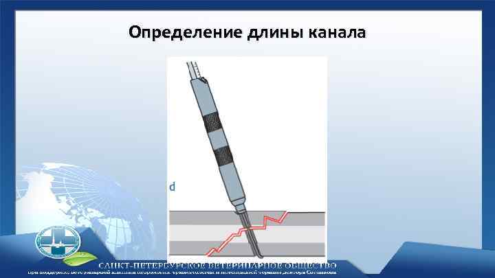 Определение длины канала 