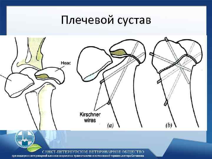 Плечевой сустав 