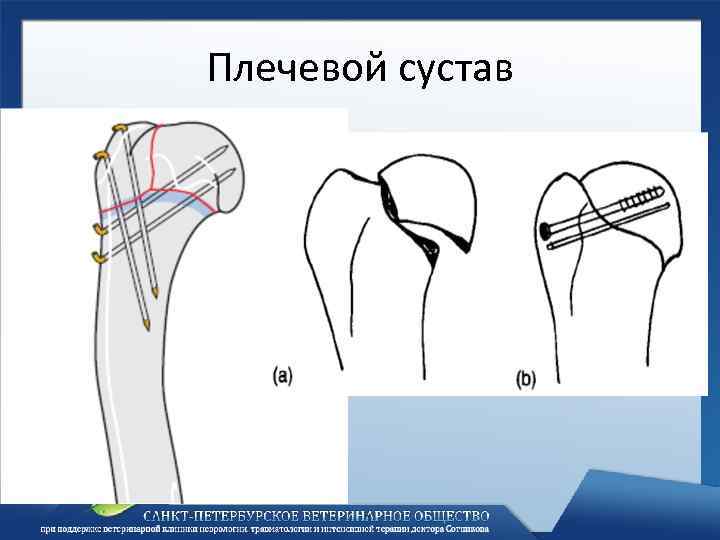 Плечевой сустав 