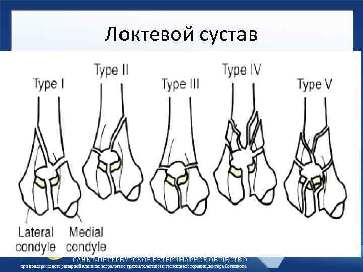 Локтевой сустав 