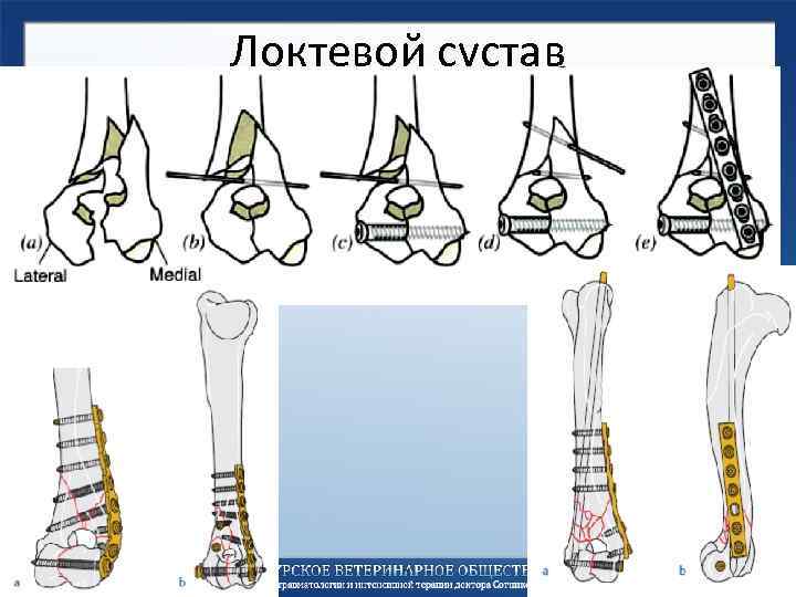 Локтевой сустав 