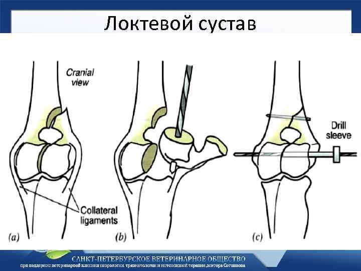 Локтевой сустав 