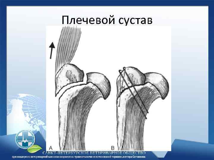 Плечевой сустав 